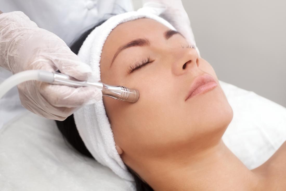 beneficial effects from microdermabrasion treatments