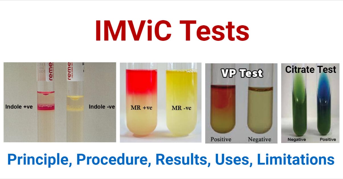 biochemical tests include all of the following except examples