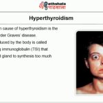 Endocrine Disorders and Their Symptoms endocrine disorders and their symptoms