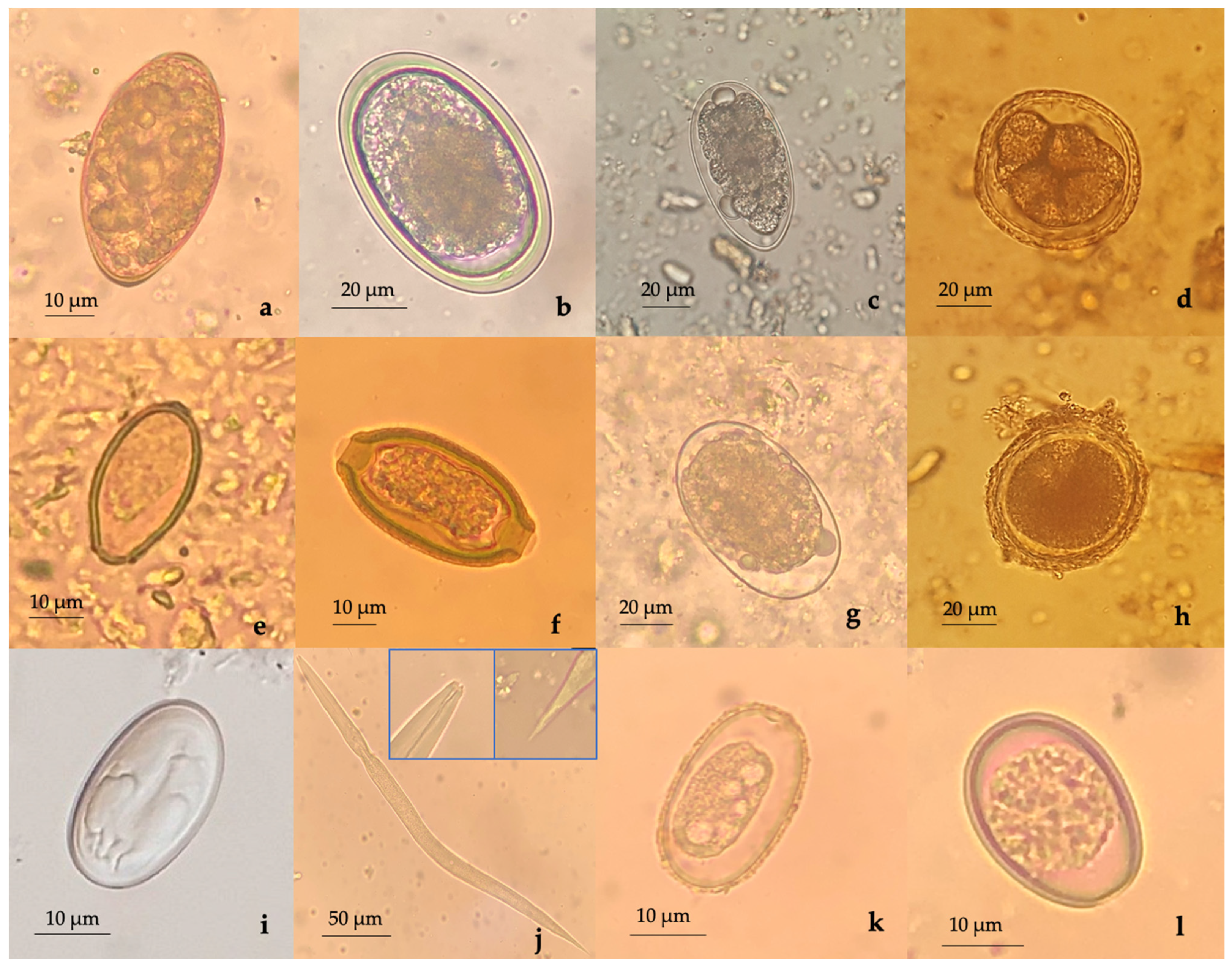 endoparasites examples and health impacts explained 1