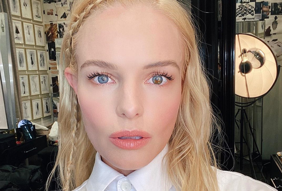 examples of central heterochromia in celebrities