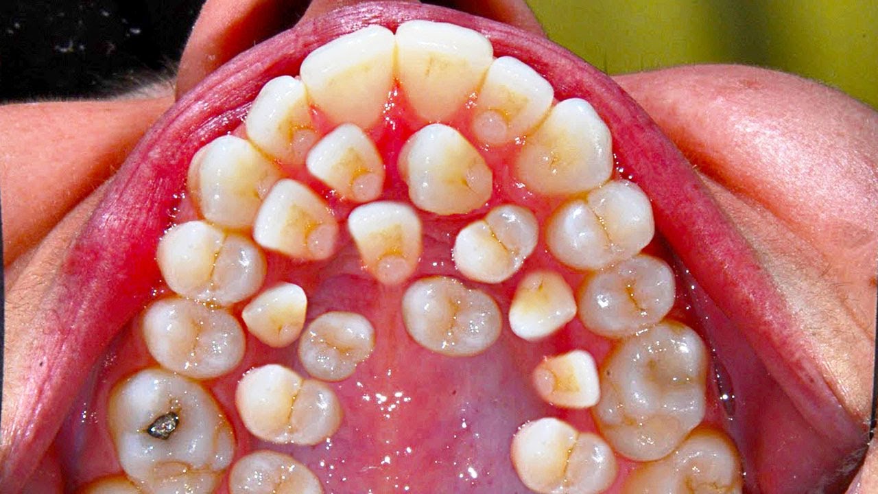 examples of dental lawsuits and their impact