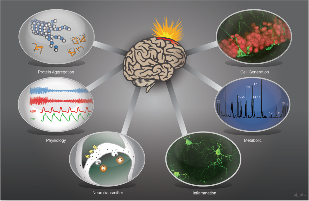examples of neuroplasticity after brain injury
