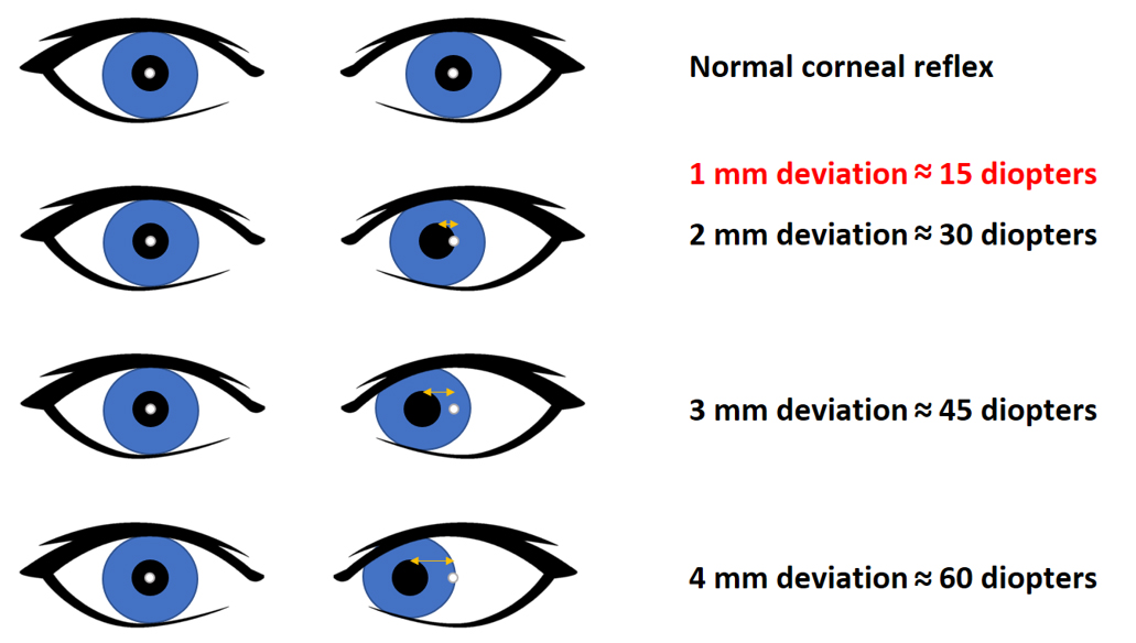 examples of the 15 15 15 rule for eye health and focus
