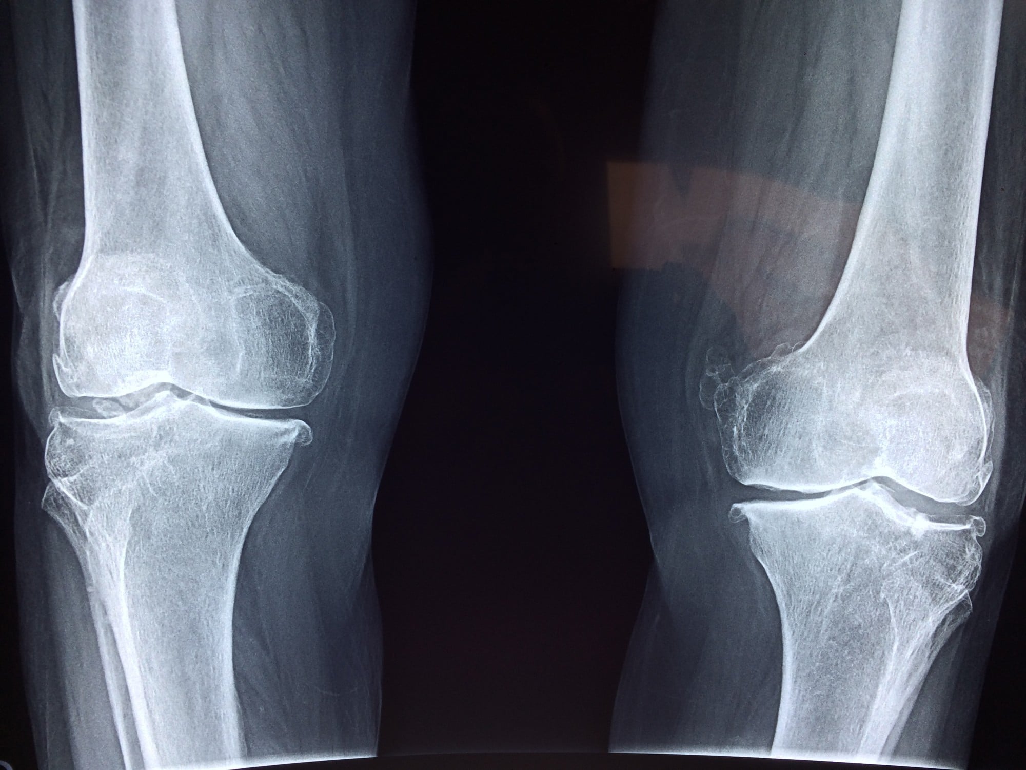 examples of x ray waves in medicine and industry applications