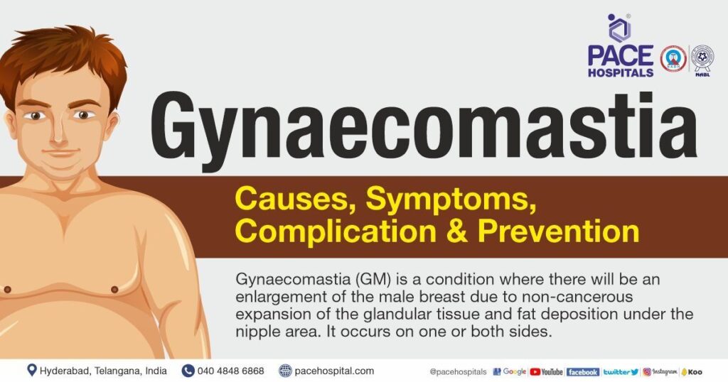 gynecomastia causes symptoms and treatments