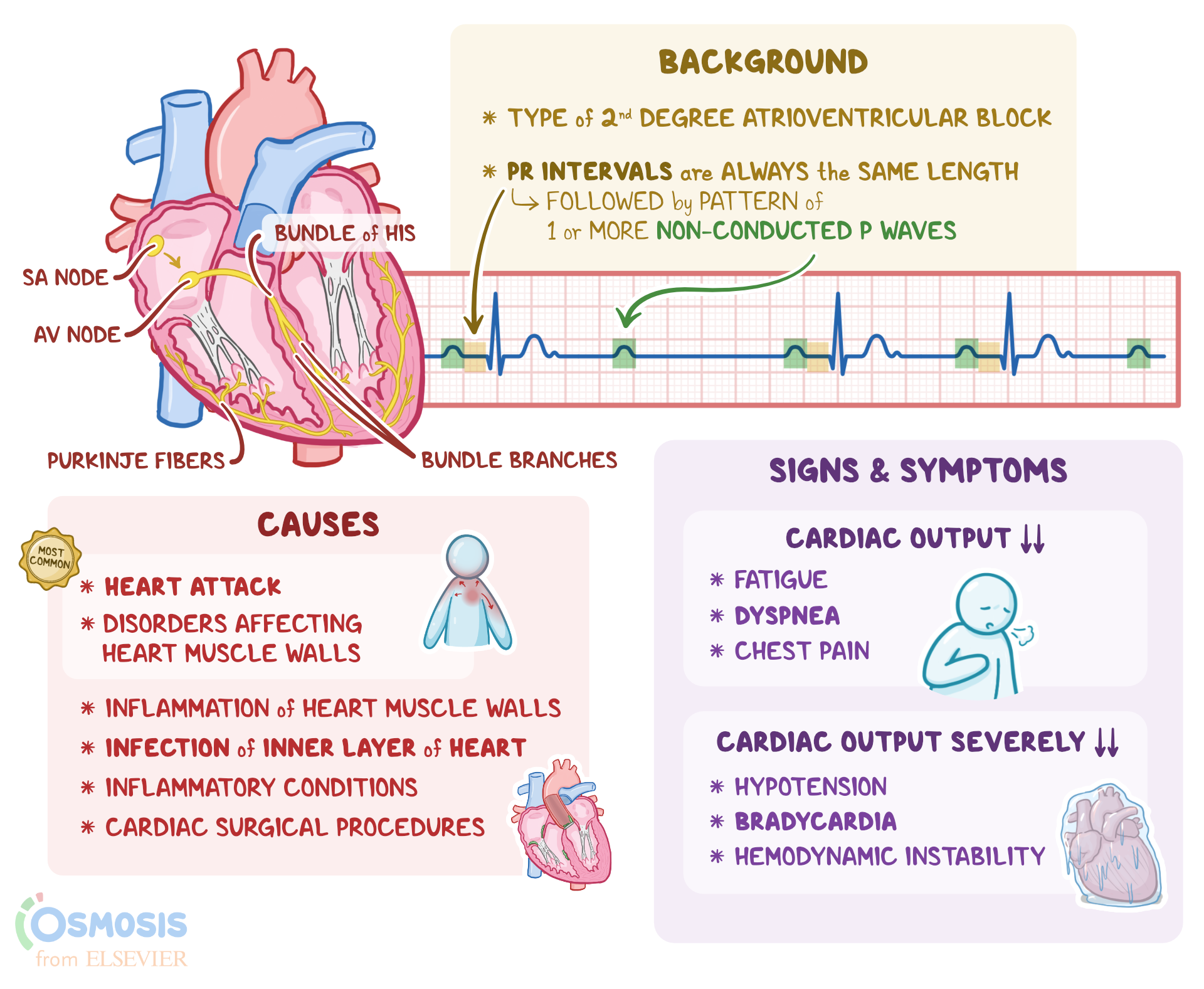 heart block symptoms types and treatments