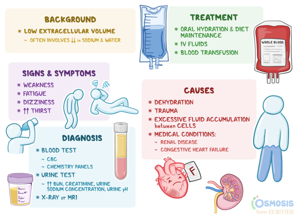 hypovolemia vs dehydration key differences explained