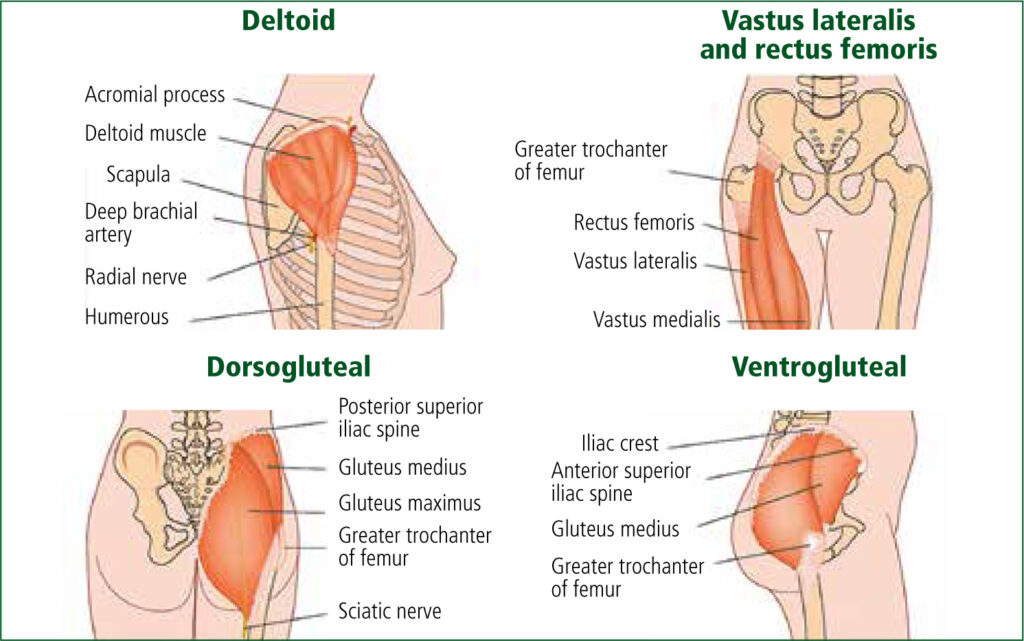 intramuscular injection examples and their uses