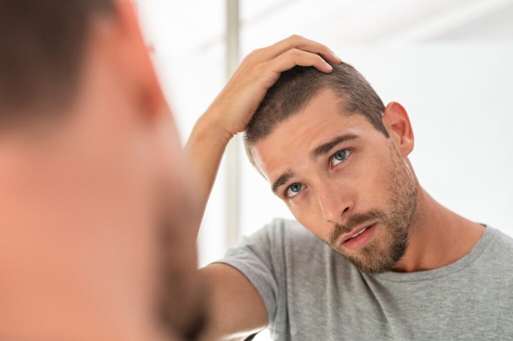 signs to know how to tell if hairline is receding 1